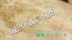 城本クリニック CMのシーン7（00:09）